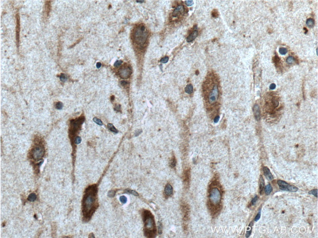 CCDC55 Antibody in Immunohistochemistry (Paraffin) (IHC (P))