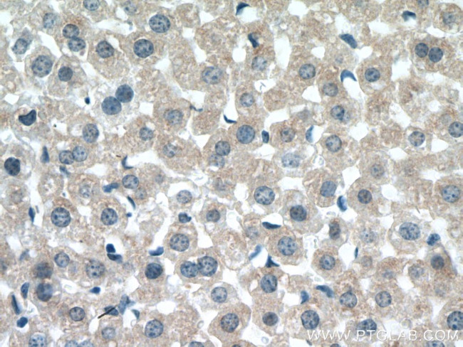 UGT3A2 Antibody in Immunohistochemistry (Paraffin) (IHC (P))