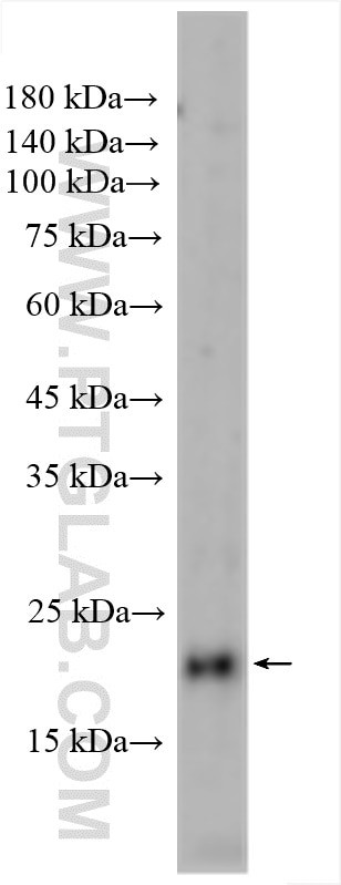 ASCL2 Antibody in Western Blot (WB)