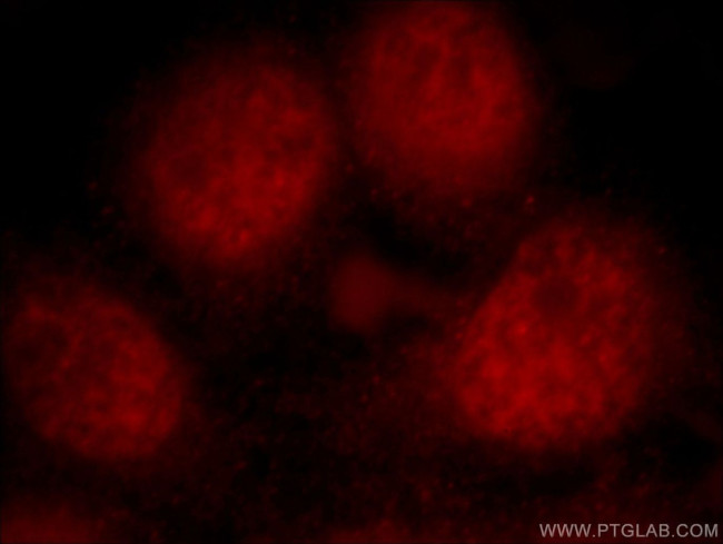 PKIG Antibody in Immunocytochemistry (ICC/IF)