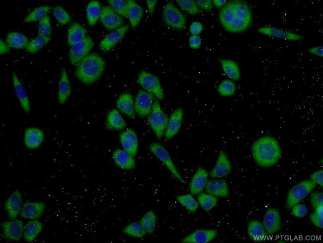 ECM2 Antibody in Immunocytochemistry (ICC/IF)