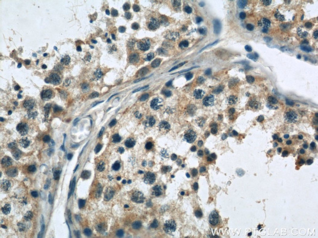SASS6 Antibody in Immunohistochemistry (Paraffin) (IHC (P))