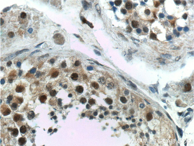GTF2A1 Antibody in Immunohistochemistry (Paraffin) (IHC (P))
