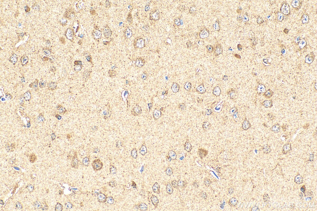 EPHB3 Antibody in Immunohistochemistry (Paraffin) (IHC (P))