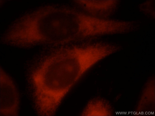 RLBP1L2 Antibody in Immunocytochemistry (ICC/IF)