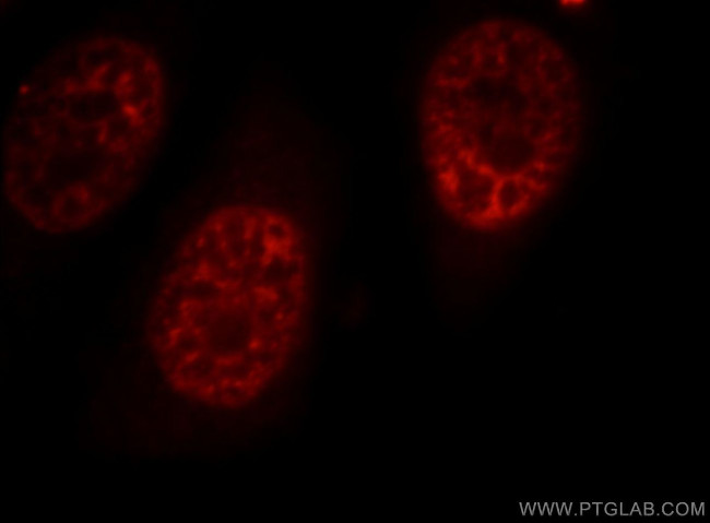SR140 Antibody in Immunocytochemistry (ICC/IF)