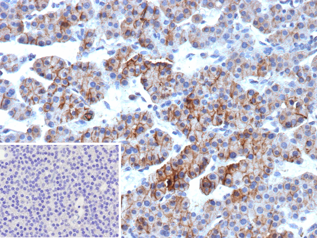 ALCAM (Activated Leukocyte Cell Adhesion Molecule)/CD166 Antibody in Immunohistochemistry (Paraffin) (IHC (P))