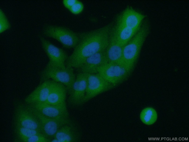APRT Antibody in Immunocytochemistry (ICC/IF)