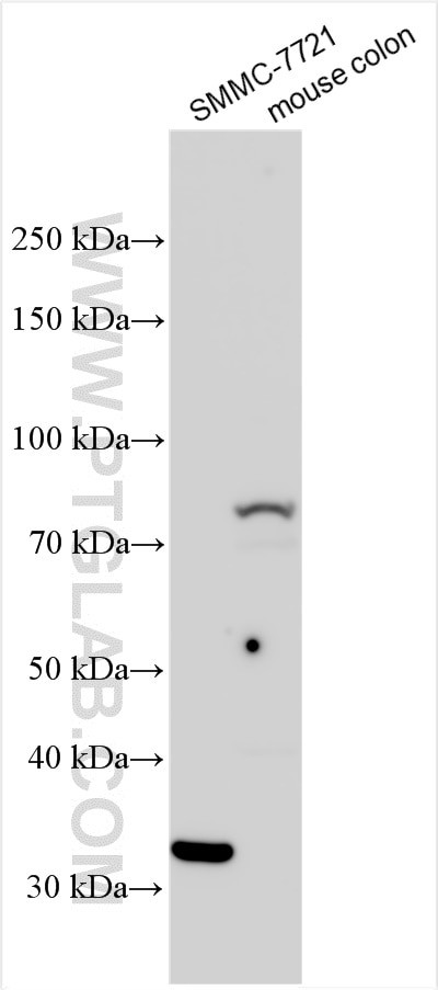 TGM3 Antibody in Western Blot (WB)