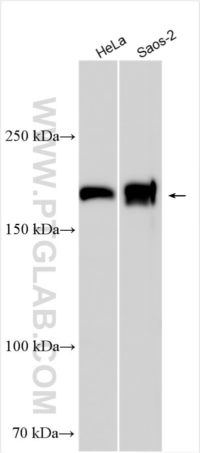 MRC2 Antibody in Western Blot (WB)