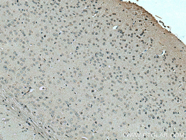 SLC24A6 Antibody in Immunohistochemistry (Paraffin) (IHC (P))