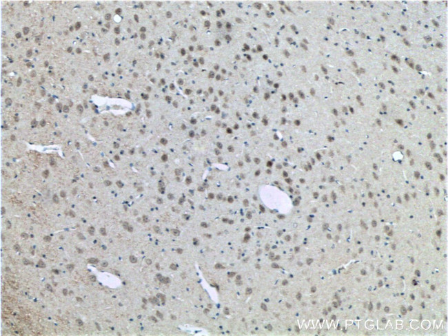 CLSTN2 Antibody in Immunohistochemistry (Paraffin) (IHC (P))