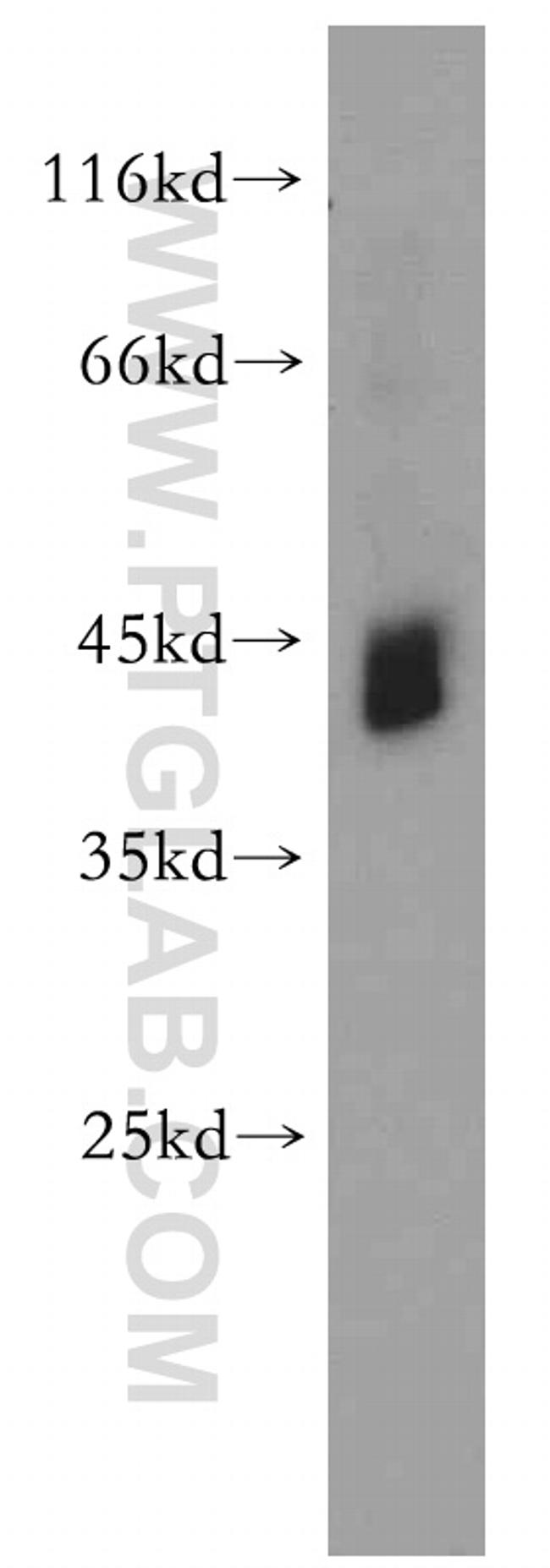 RNF150 Antibody in Western Blot (WB)
