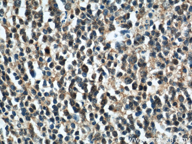 Rubicon Antibody in Immunohistochemistry (Paraffin) (IHC (P))
