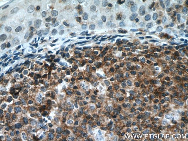 PVRIG Antibody in Immunohistochemistry (Paraffin) (IHC (P))