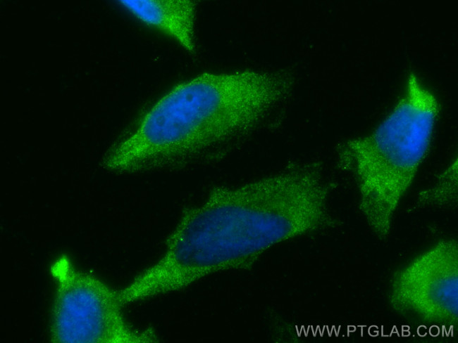 BAT2L Antibody in Immunocytochemistry (ICC/IF)