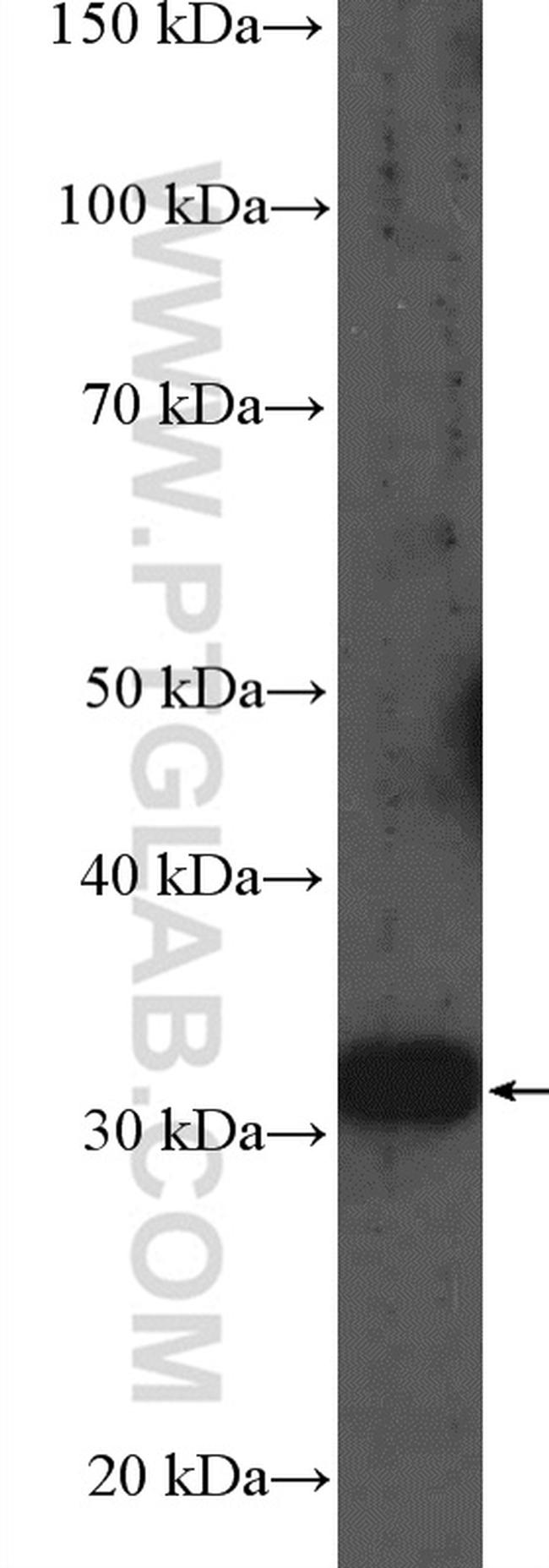 MMACHC Antibody in Western Blot (WB)