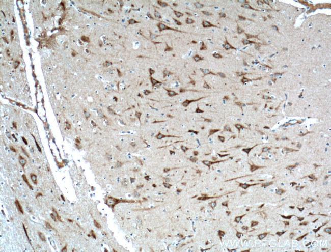 TMEM230 Antibody in Immunohistochemistry (Paraffin) (IHC (P))