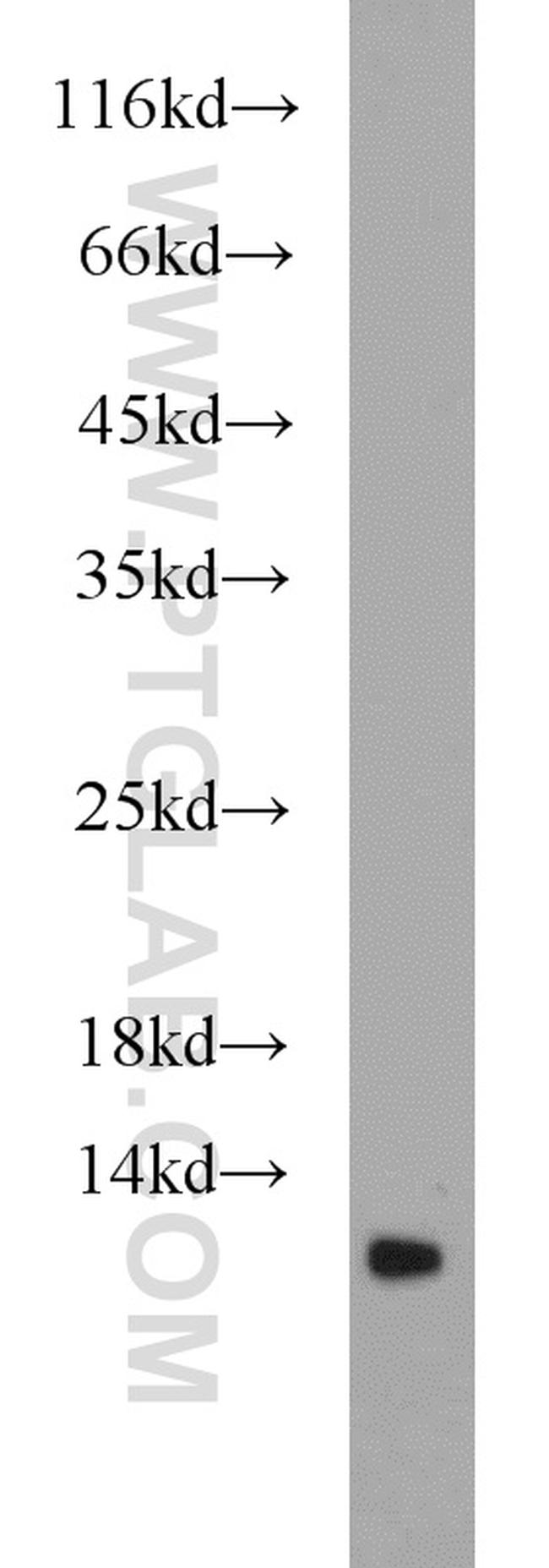 DMRTC1B Antibody in Western Blot (WB)