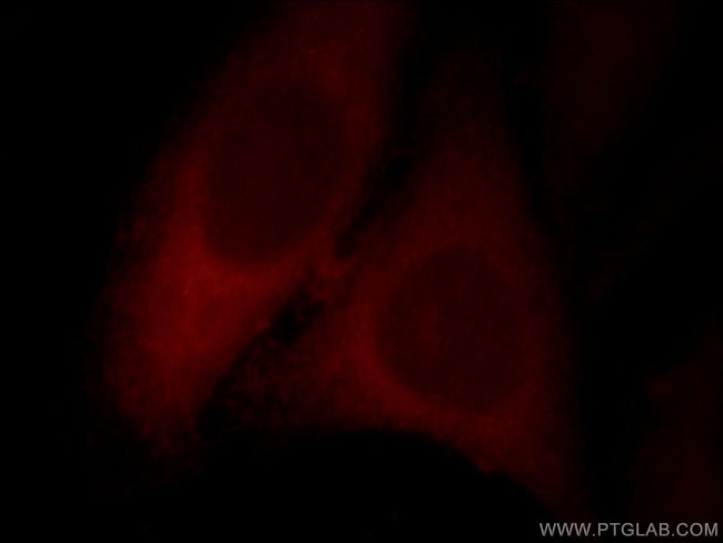 SYNPO2L Antibody in Immunocytochemistry (ICC/IF)