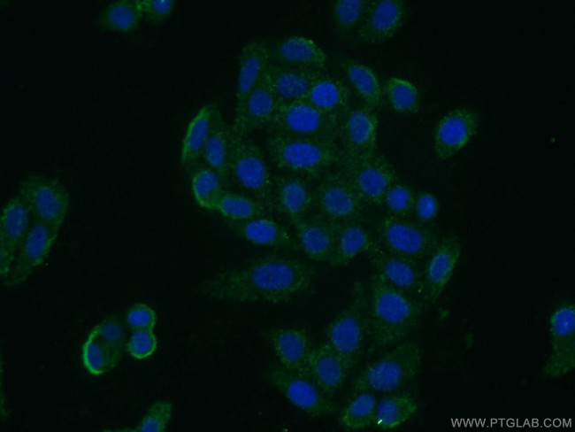 PLP2 Antibody in Immunocytochemistry (ICC/IF)