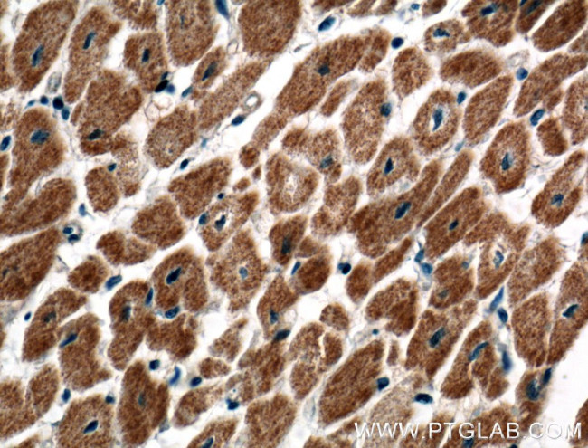 C20orf160 Antibody in Immunohistochemistry (Paraffin) (IHC (P))