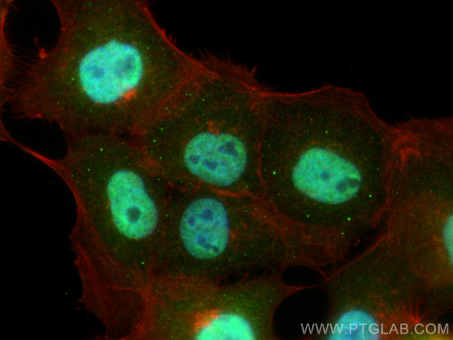 SLITRK5 Antibody in Immunocytochemistry (ICC/IF)