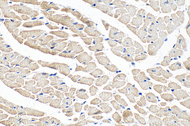 NEBL Antibody in Immunohistochemistry (Paraffin) (IHC (P))