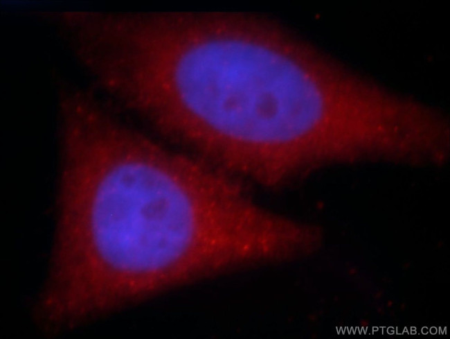 SH3D19 Antibody in Immunocytochemistry (ICC/IF)