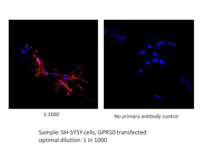 GPR50 Antibody in Immunocytochemistry (ICC/IF)
