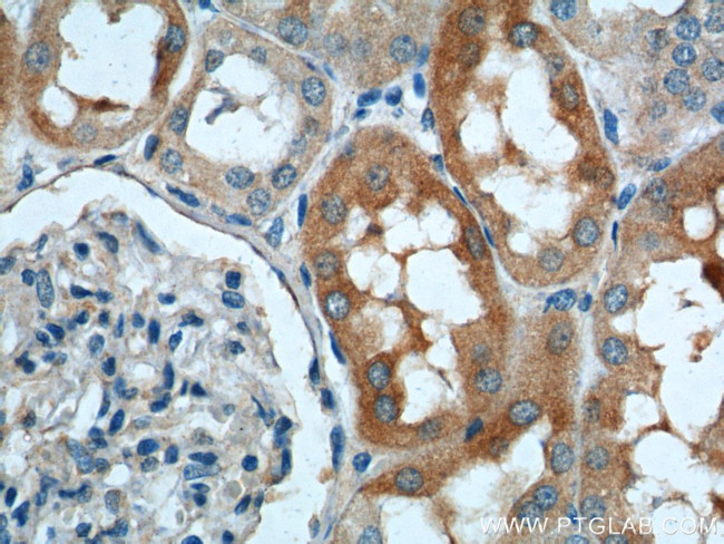 SLC4A1AP Antibody in Immunohistochemistry (Paraffin) (IHC (P))