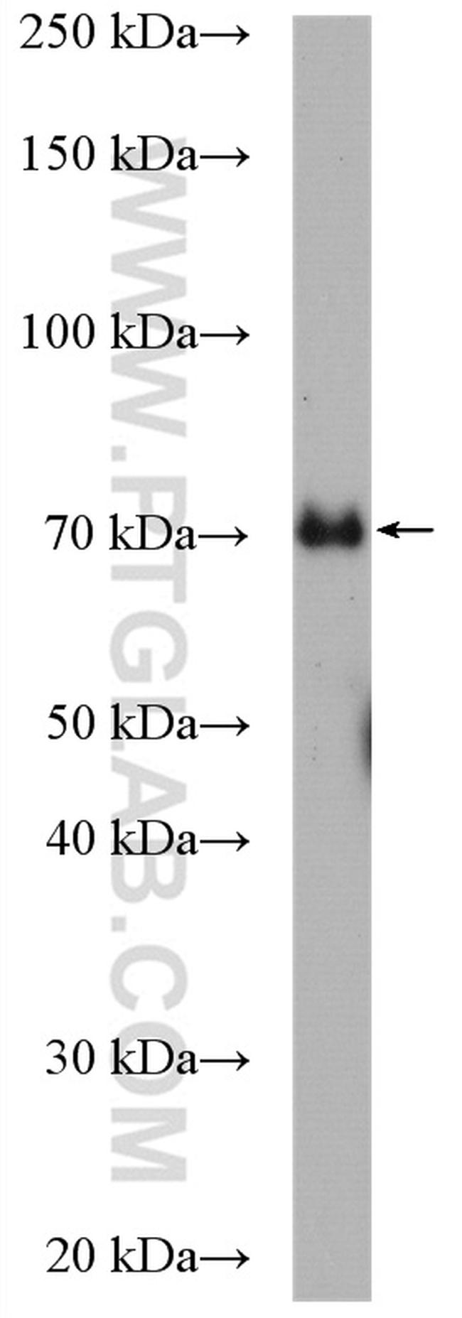 ITK Antibody in Western Blot (WB)