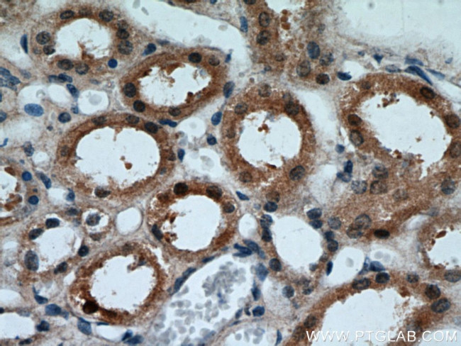 FOXO4 Antibody in Immunohistochemistry (Paraffin) (IHC (P))