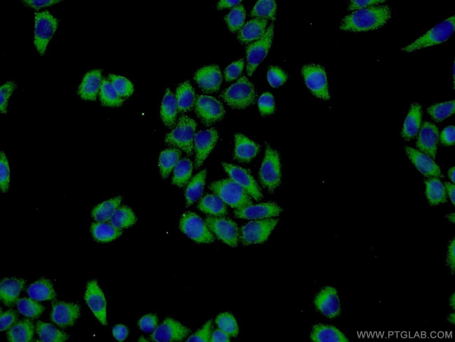 ISM2 Antibody in Immunocytochemistry (ICC/IF)