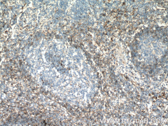 FCGR2B / CD32b Antibody in Immunohistochemistry (Paraffin) (IHC (P))