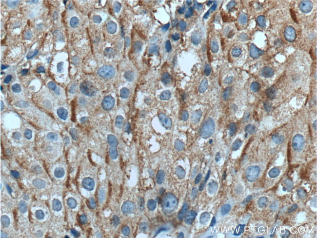 TUSC5 Antibody in Immunohistochemistry (Paraffin) (IHC (P))