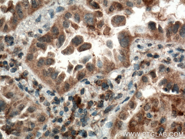 CYP2F1 Antibody in Immunohistochemistry (Paraffin) (IHC (P))