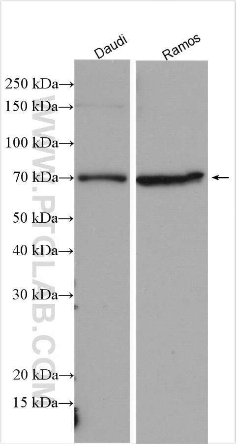 BTK Antibody in Western Blot (WB)