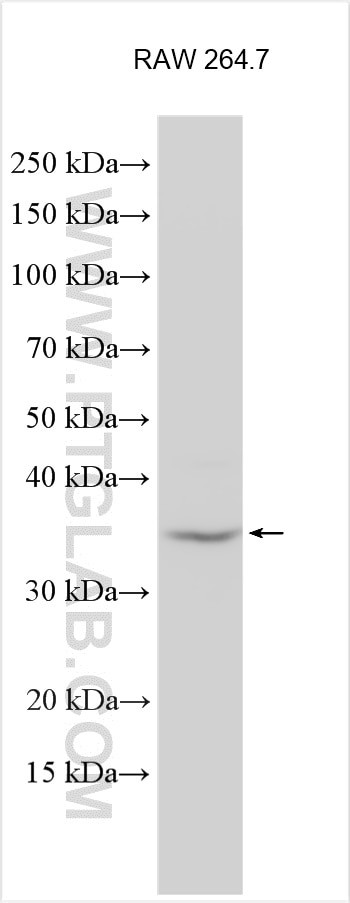 ZNF75D Antibody in Western Blot (WB)