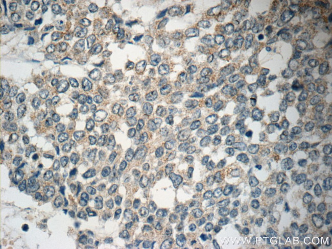NGX6 Antibody in Immunohistochemistry (Paraffin) (IHC (P))