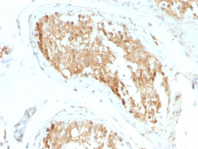 ALDH1A1 (Aldehyde Dehydrogenase 1A1) Antibody in Immunohistochemistry (Paraffin) (IHC (P))