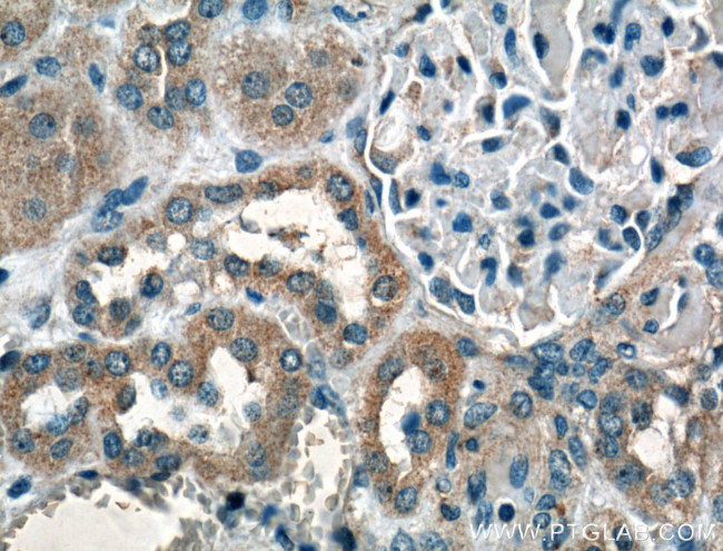 PFTK1 Antibody in Immunohistochemistry (Paraffin) (IHC (P))