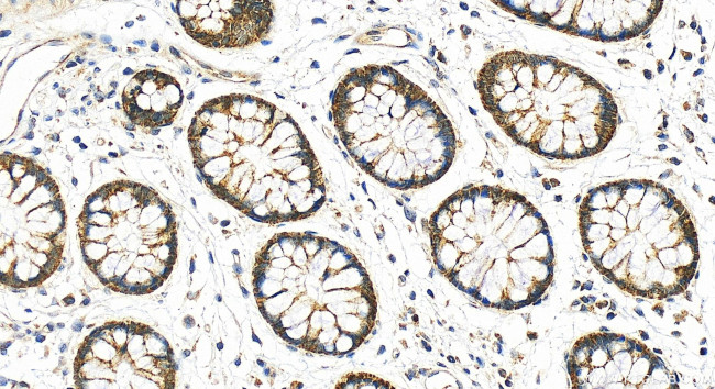 MRP63 Antibody in Immunohistochemistry (Paraffin) (IHC (P))