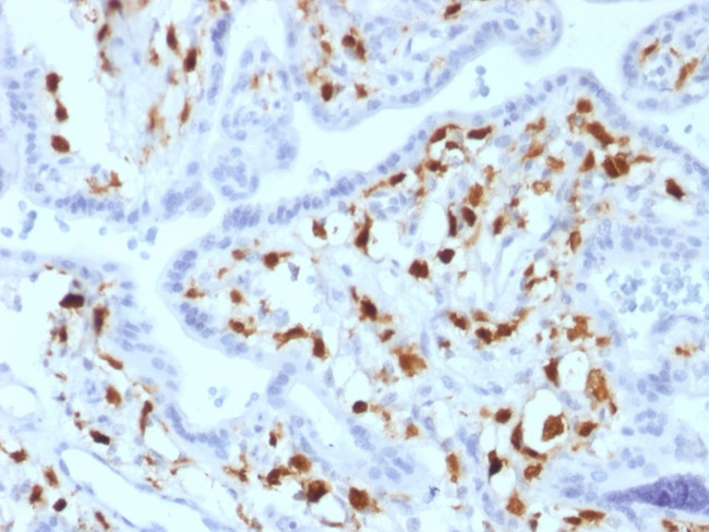 Factor XIIIa (Coagulation Factor XIIIA Chain) Antibody in Immunohistochemistry (Paraffin) (IHC (P))
