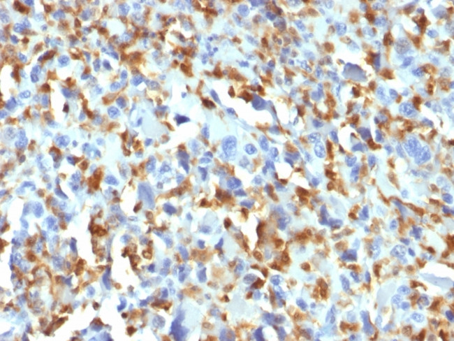 Factor XIIIa (Coagulation Factor XIIIA Chain) Antibody in Immunohistochemistry (Paraffin) (IHC (P))