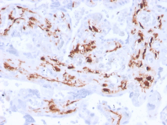 Factor XIIIa (Coagulation Factor XIIIA Chain) Antibody in Immunohistochemistry (Paraffin) (IHC (P))