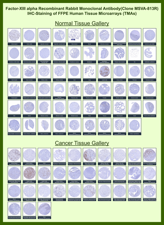 Factor XIIIa (Coagulation Factor XIIIA Chain) Antibody in Immunohistochemistry (Paraffin) (IHC (P))