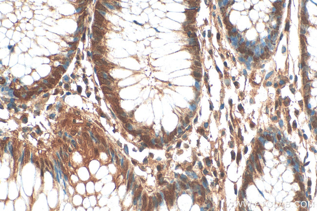 ZSCAN29 Antibody in Immunohistochemistry (Paraffin) (IHC (P))