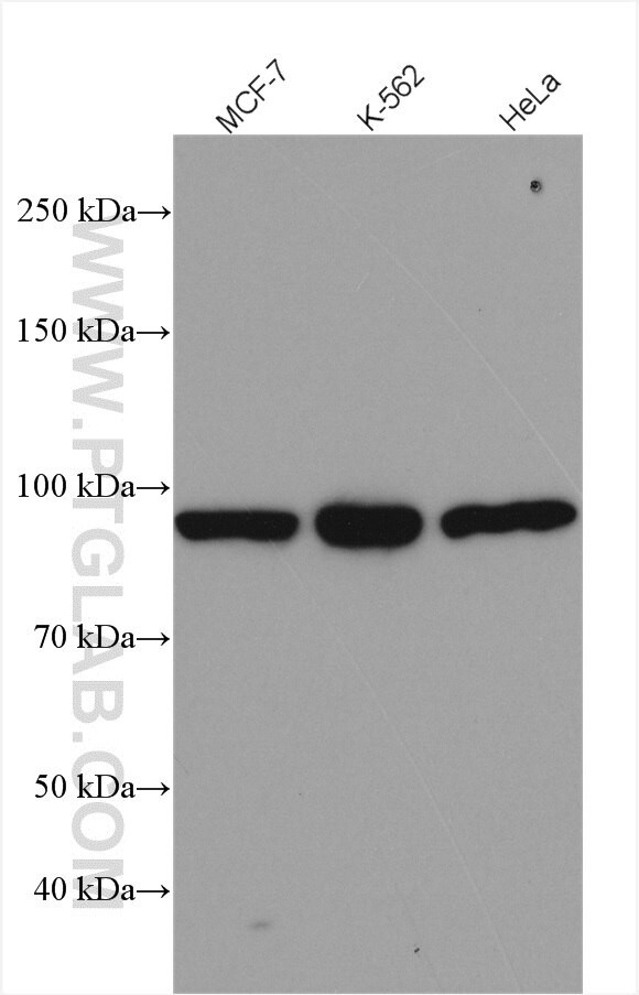 PATL1 Antibody in Western Blot (WB)