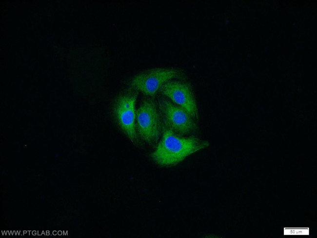 MAP1B Polyclonal Antibody (21633-1-AP)